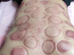 -沈师傅盲人按摩工作室(密三小区店)