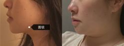 -上海漾颜医疗美容