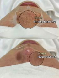 -LUNA皮相美·骨相美高级美感