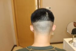 -大麦微针植发丨全国连锁