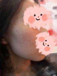 体验后-南京医科大学友谊整形外科医院