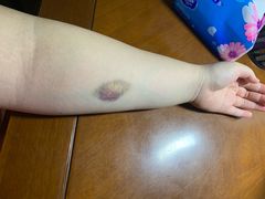 -上海市第七人民医院