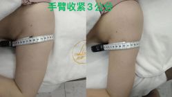 -Lily纤美·科技减脂中心