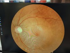 -宝岛眼镜(苏州浒关店)