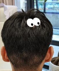 -大麦微针植发丨全国连锁