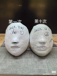 -小颜秘家·韩国整骨