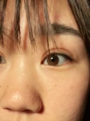 -北京叶子整形美容医院