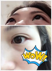 -斐研美医疗美容·眼周抗衰中心