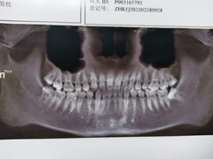 -重庆医科大学附属第一医院(本部)