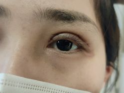 体验后-西安现代妇产医院医疗美容