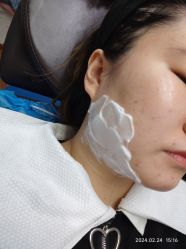 体验前-洁铭新加坡医美