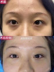-上海漾颜医疗美容