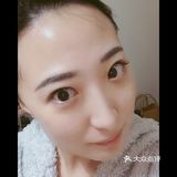 1月29日打了第二针菁芙水光针，目的是保湿