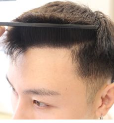 -大麦微针植发全国连锁