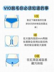 -薇兰专业脱毛连锁机构