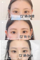 -久匠·纹眉纹绣半永久