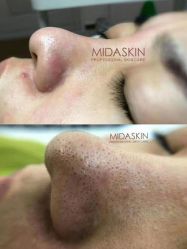 -MIDASKIN蜜哒科技美肤连锁