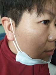 -北京美痣堂古方祛痣斑疣瘊