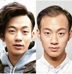 -发饰美男士增发补发假发定制店