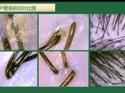 -章光101防脱养发荟