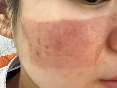 -上海皮肤专科医院