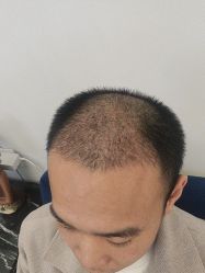 -熙朵美学植发·连锁品牌