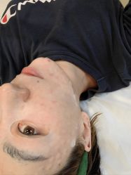 -海涛医疗美容·面部抗衰·注射美鼻