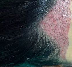 -雍禾植发全国连锁