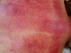 -莱蔻·圣灸堂·推拿艾灸(天山店)