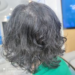 -雍禾植发全国连锁