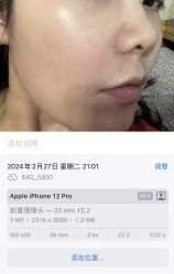 -海涛医疗美容·面部抗衰·注射美鼻