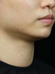 -广州美莱医疗美容医院
