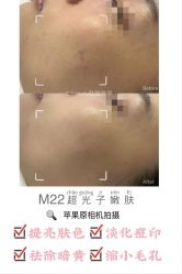 -E.beauty驻颜·痘敏肌调理中心