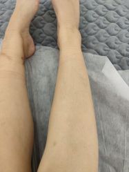 -MUSES专业脱毛日式比基尼サロン连锁
