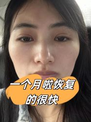 -素美医疗美容·西南眼鼻整形·修复基地