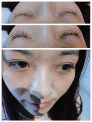 iphone_upload_pic-光SPA科技美肤