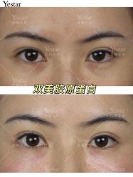 -Yestar艺星医疗美容医院