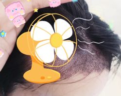 -大麦微针植发全国连锁