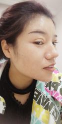 体验前-西安壹加壹医疗美容·西北抗衰旗舰店