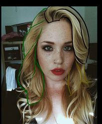 -大麦微针植发全国连锁