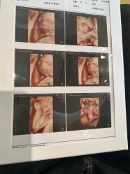 -杭州贝瑞斯美华妇儿医院·早孕·产检·儿科