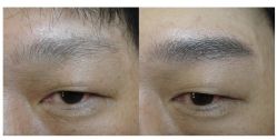 点击看大图 -西施无菌半永久纹绣眉眼影唇轻增发纹发际线
