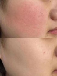 -美愈美肤MEIYU SKIN