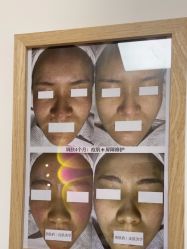 -美肤盾祛痘·问题肌头疗管理中心