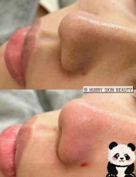 -哈颜科技轻美·