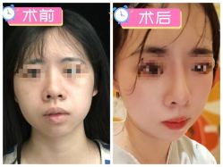 -素美医疗美容·西南眼鼻整形·修复基地