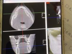 -土豆口腔(凤凰北总店)