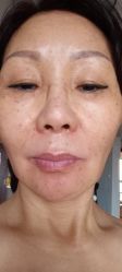 -坤如玛丽·医疗美容中心