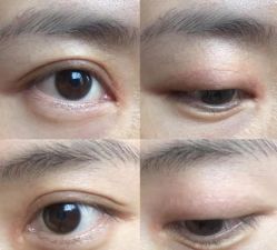 -安徽合肥韩美整形外科医院