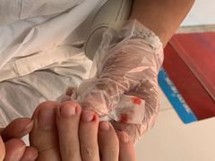 -新甲连锁灰指甲·甲沟炎·鸡眼(黑龙江路店)